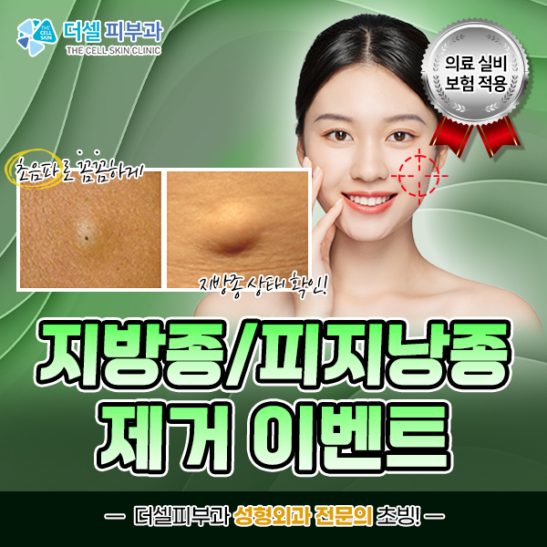 모바일
