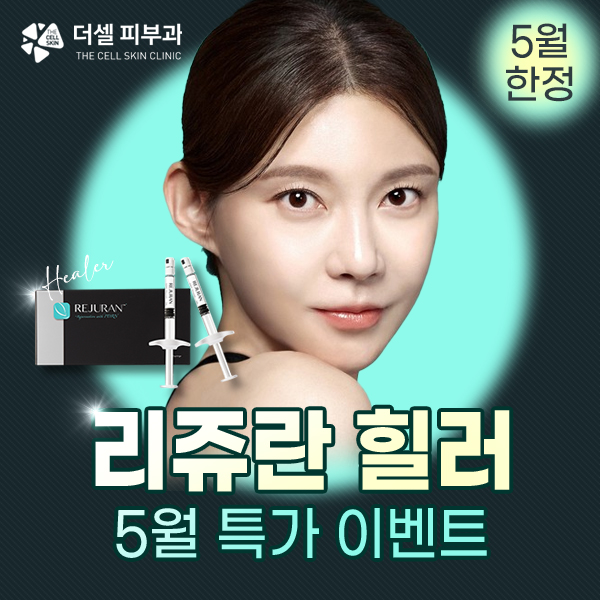 모바일